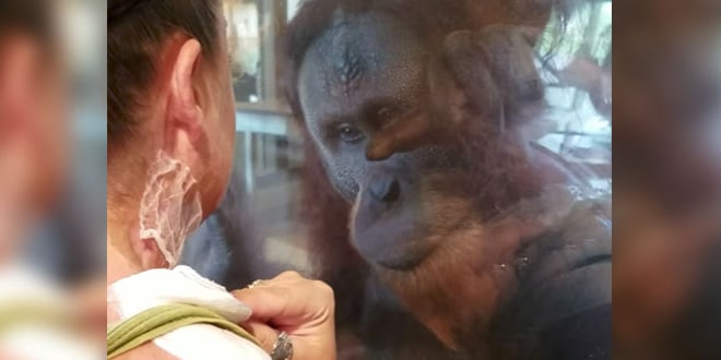 Az égési sebeket nézi az orangután a nő nyakán